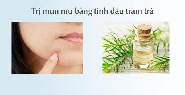 Trị mụn mủ tại nhà bằng tinh dầu tràm trà