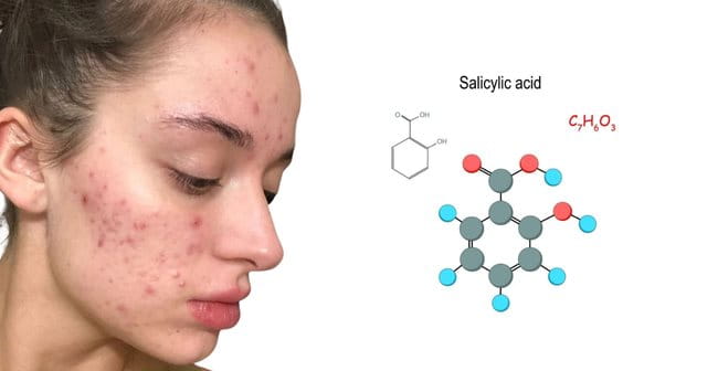 Cách hết mụn tuổi dậy thì với sản phẩm chứa Salicylic Acid