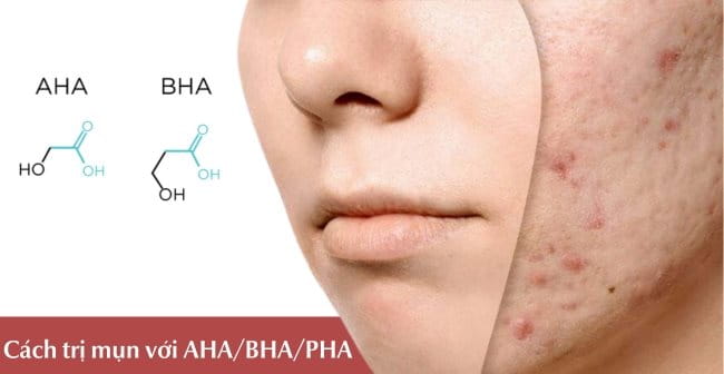 Cách trị mụn trên mặt với AHA/BHA/PHA