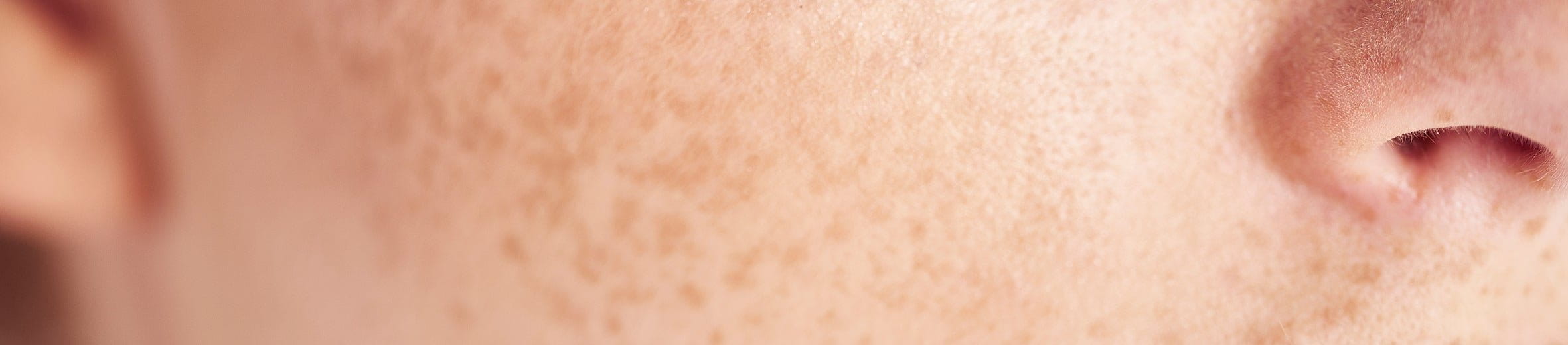 Cách trị nám chân sâu hiệu quả