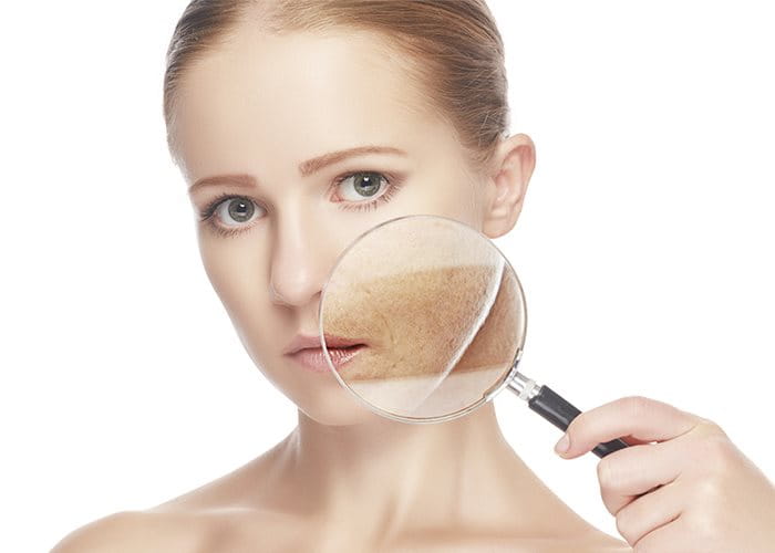 cach-tri-nam-tai-nha