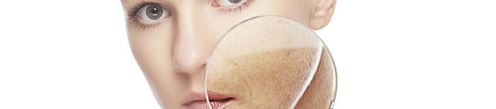 cach-tri-nam-tai-nha