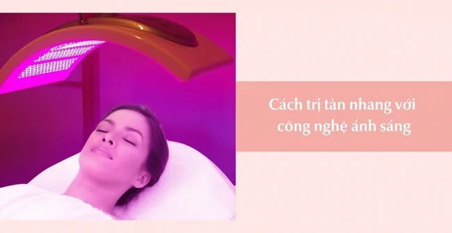 Cách trị tàn nhang với công nghệ ánh sáng