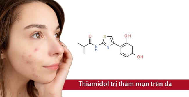 Trị thâm mụn nhanh nhất với Thiamidol