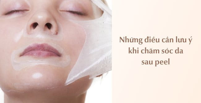 Những lưu ý khi chăm sóc da sau peel