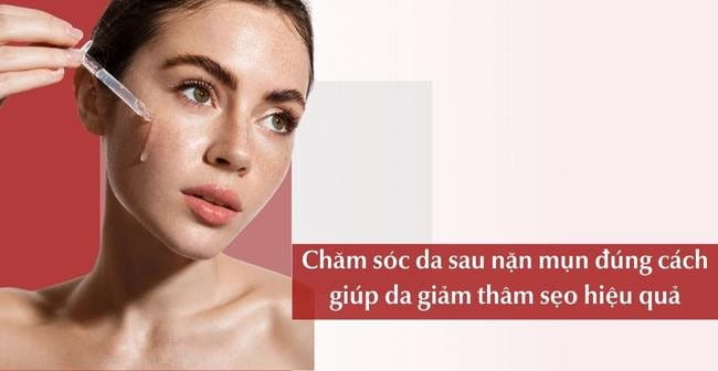 Chăm sóc da sau nặn mụn đúng cách giúp nhanh lành vết thương và giảm thâm, sẹo hiệu quả 