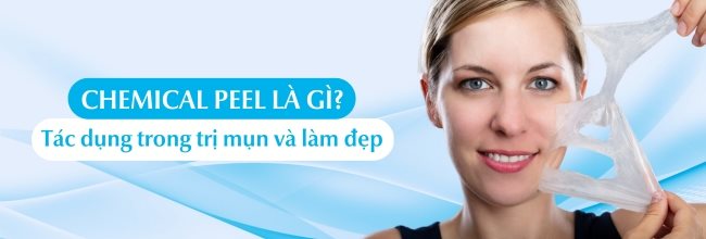 Chemical peel là gì