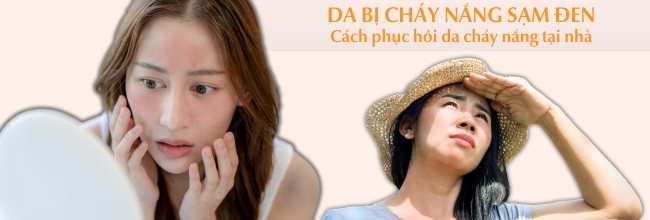 Da bị cháy nắng sạm đen phải làm sao? Cách phục hồi da cháy nắng