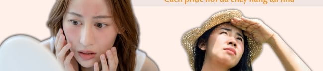 Da bị cháy nắng sạm đen phải làm sao? Cách phục hồi da cháy nắng