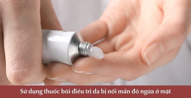 Sử dụng thuốc điều trị da bị nổi mẩn đỏ ngứa ở mặt