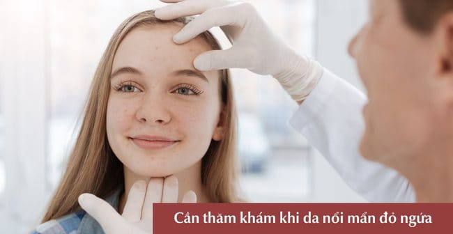 Nên làm gì khi da bị nổi mẩn đỏ ngứa?