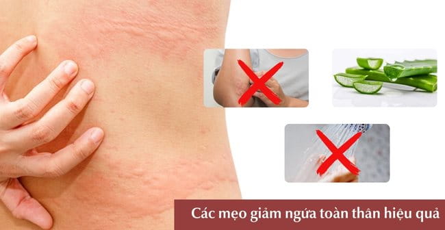 Các mẹo giảm ngứa toàn thân hiệu quả