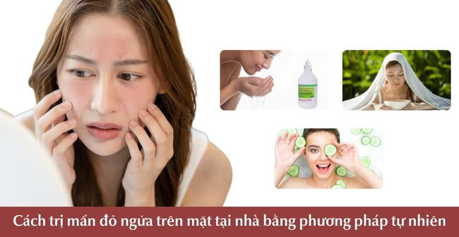 Cách trị mẩn đỏ ngứa trên mặt tại nhà bằng phương pháp tự nhiên