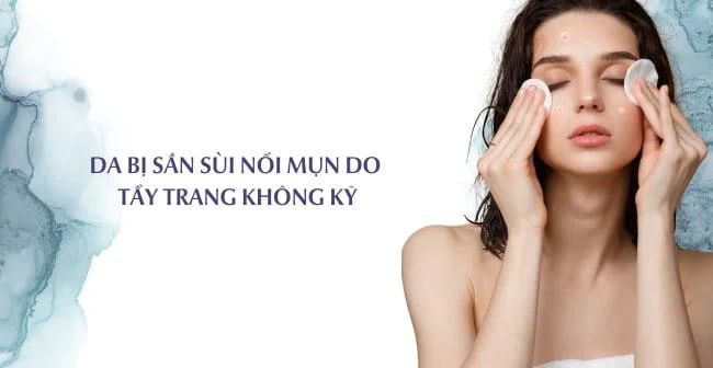 Da bị sần sùi nổi mụn do tẩy trang không kỹ