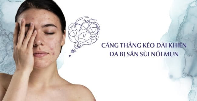 Căng thẳng kéo dài khiến da bị sần sùi nổi mụn