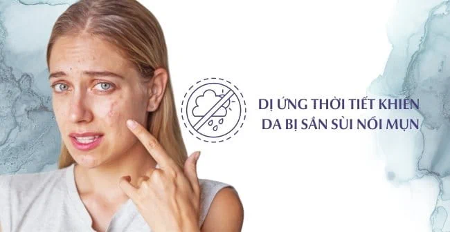 Dị ứng thời tiết khiến da bị sần sùi nổi mụn