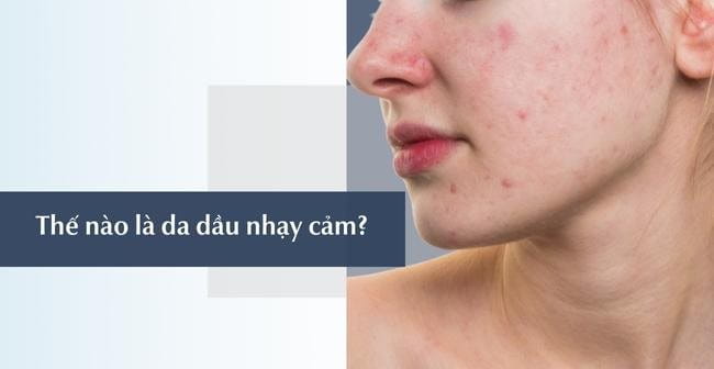 Da dầu nhạy cảm là làn da như thế nào? 