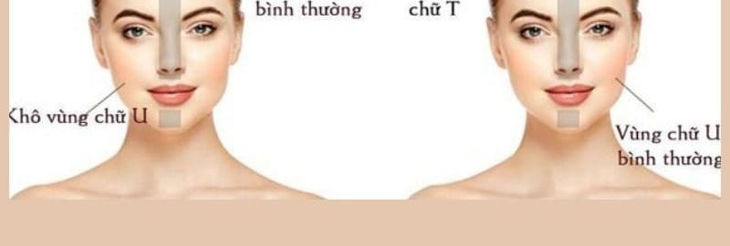 Da hỗn hợp thiên dầu là gì? Cách nhận biết và quy trình chăm sóc da hiệu  quả nhất