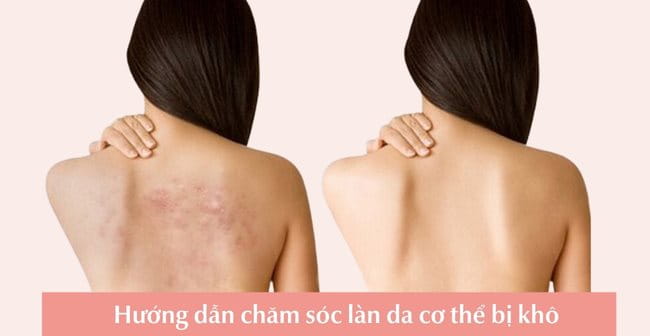 Cách chăm sóc da khô toàn thân tại nhà