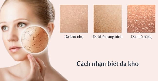 Cách nhận biết da khô