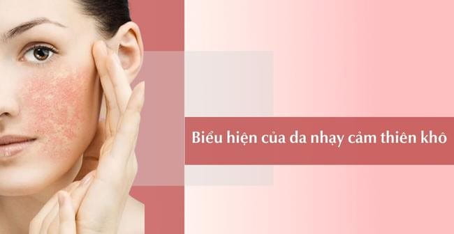 Da khô nhạy cảm dễ kích ứng 