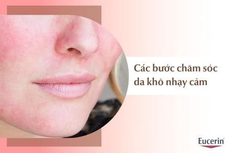 Quy trình chăm sóc da khô nhạy cảm đơn giản, hiệu quả