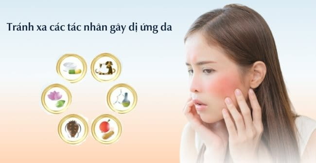 Da mặt bị ngứa và sần sùi tránh xa các tác nhân gây dị ứng da