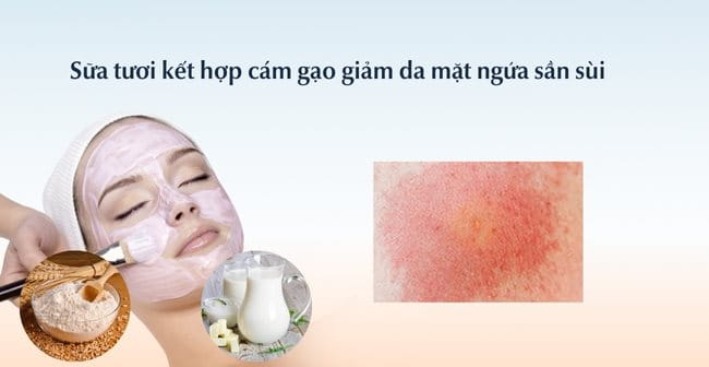 Sữa tươi kết hợp cám gạo làm dịu da mặt dị ứng nổi sần ngứa