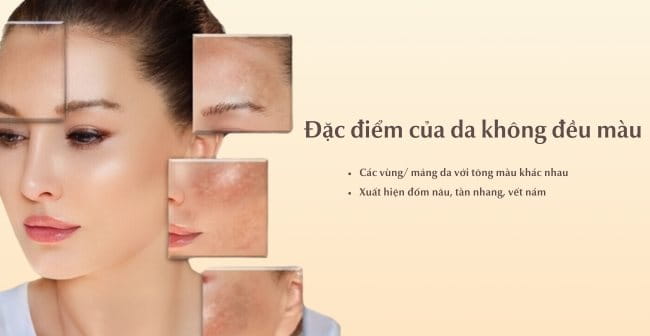 Đặc điểm của da không đều màu là gì?