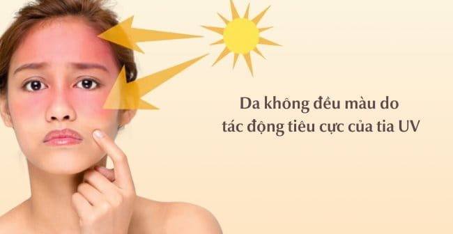 Da không đều màu do tác động tiêu cực của tia UV