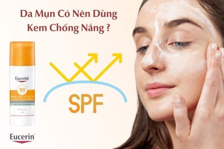 Da Mụn Có Nên Dùng Kem Chống Nắng Không? Cách Chọn & Sử Dụng