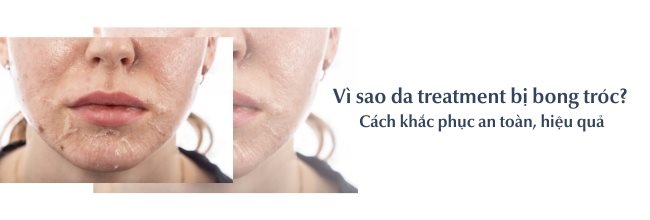 Da treatment bị bong tróc