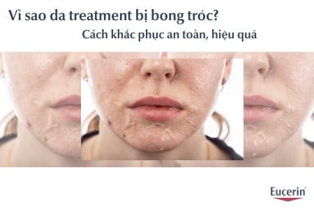 Vì sao da treatment bị bong tróc? Cách khắc phục treatment bị bong da