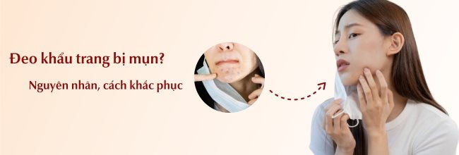 Đeo khẩu trang bị mụn do đâu? Cách khắc phục hiệu quả