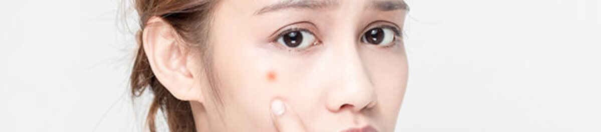dược mỹ phẩm trị mụn