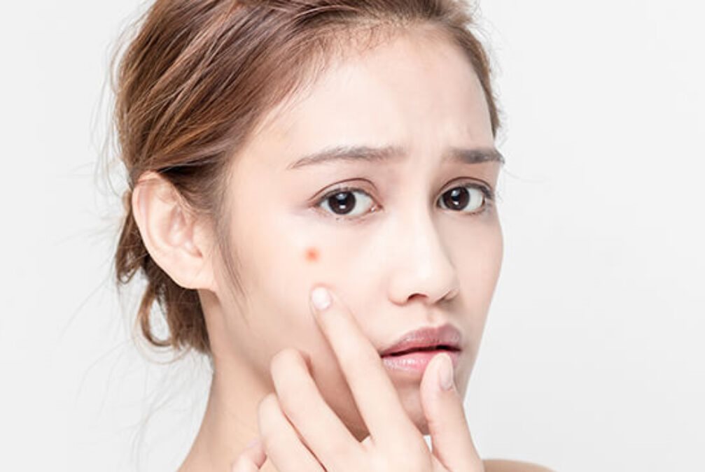 dược mỹ phẩm trị mụn