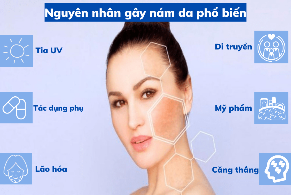 nguyên nhân gây nám da