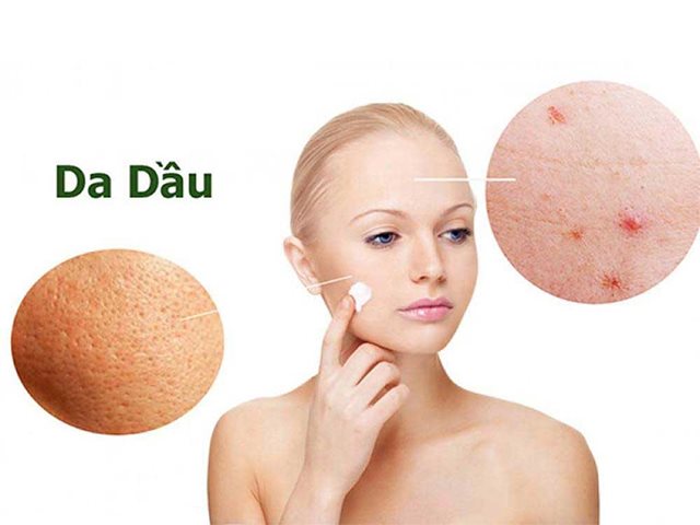 kem trị mụn cho da dầu