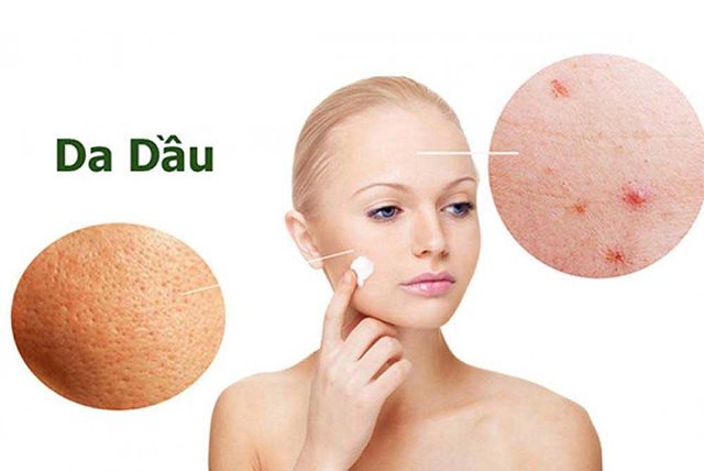 kem trị mụn cho da dầu