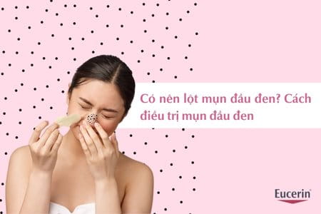 Sản Phẩm Lột Mụn Đầu Đen - Top 5 Sản Phẩm Hiệu Quả Và An Toàn Nhất