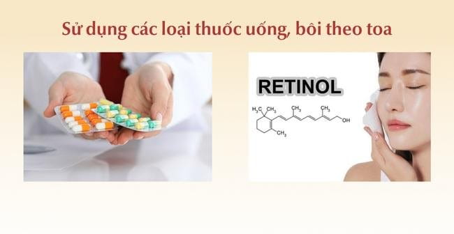 Sử dụng các loại thuốc uống, bôi theo toa