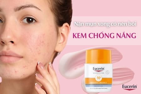 Vừa mới nặn mụn xong có nên bôi kem chống nắng không? 