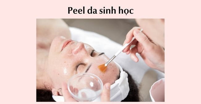 Peel da - Phương pháp điều trị mụn ẩn trên trán chuẩn y khoa