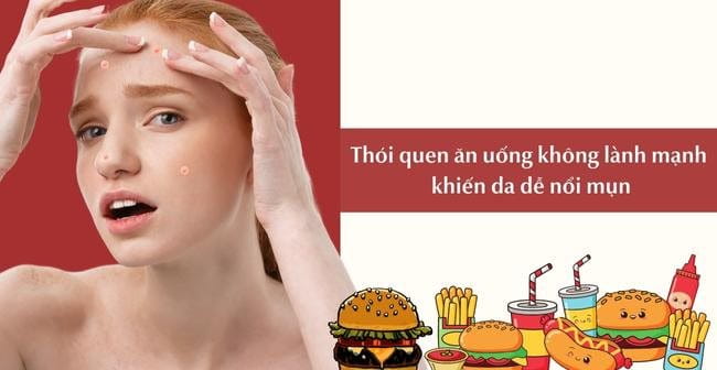 Thói quen ăn uống không lành mạnh khiến da dễ nổi mụn