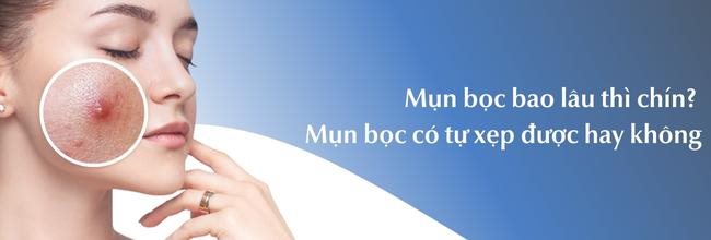 Mụn bọc bao lâu thì chín? Mụn bọc có tự xẹp không