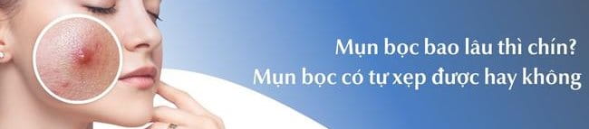 Mụn bọc bao lâu thì chín? Mụn bọc có tự xẹp không