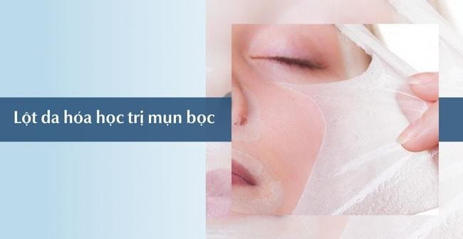 Trị mụn bọc ở cằm bằng phương pháp lột da hóa học