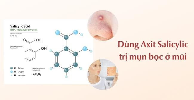 Xử lý mụn bọc ở mũi bằng Axit Salicylic