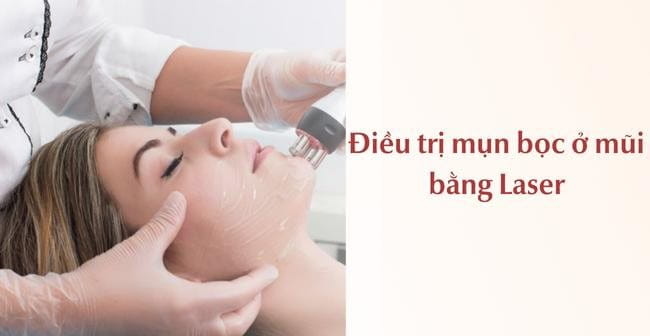 Trị mụn bọc ở mũi bằng phương pháp Laser