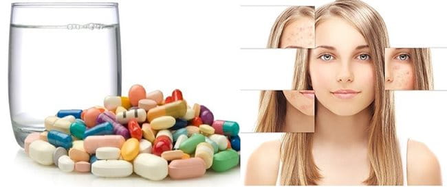 Uống kháng sinh kê đơn là một trong những cách trị mụn nhanh chóng